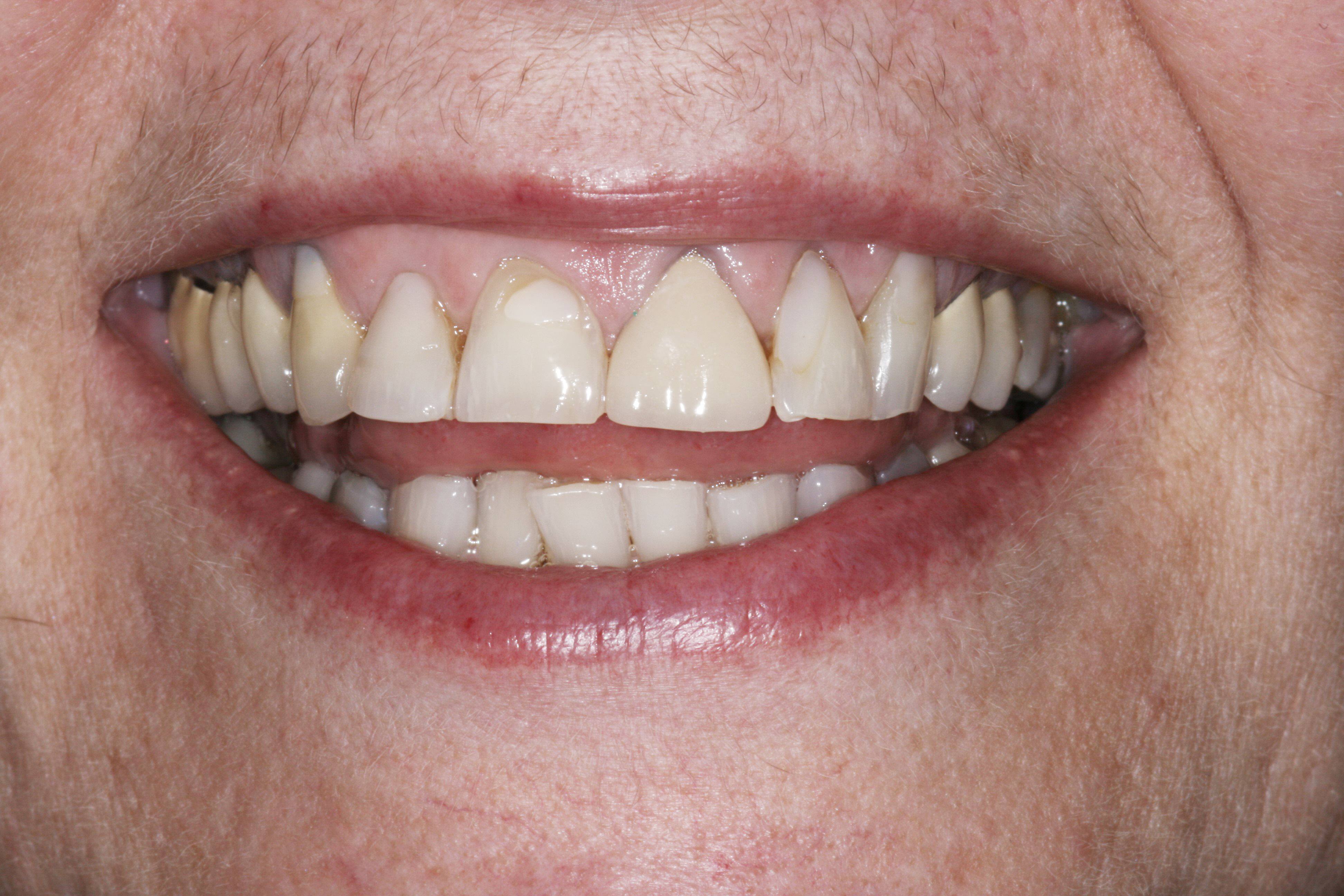 Smile Gallery