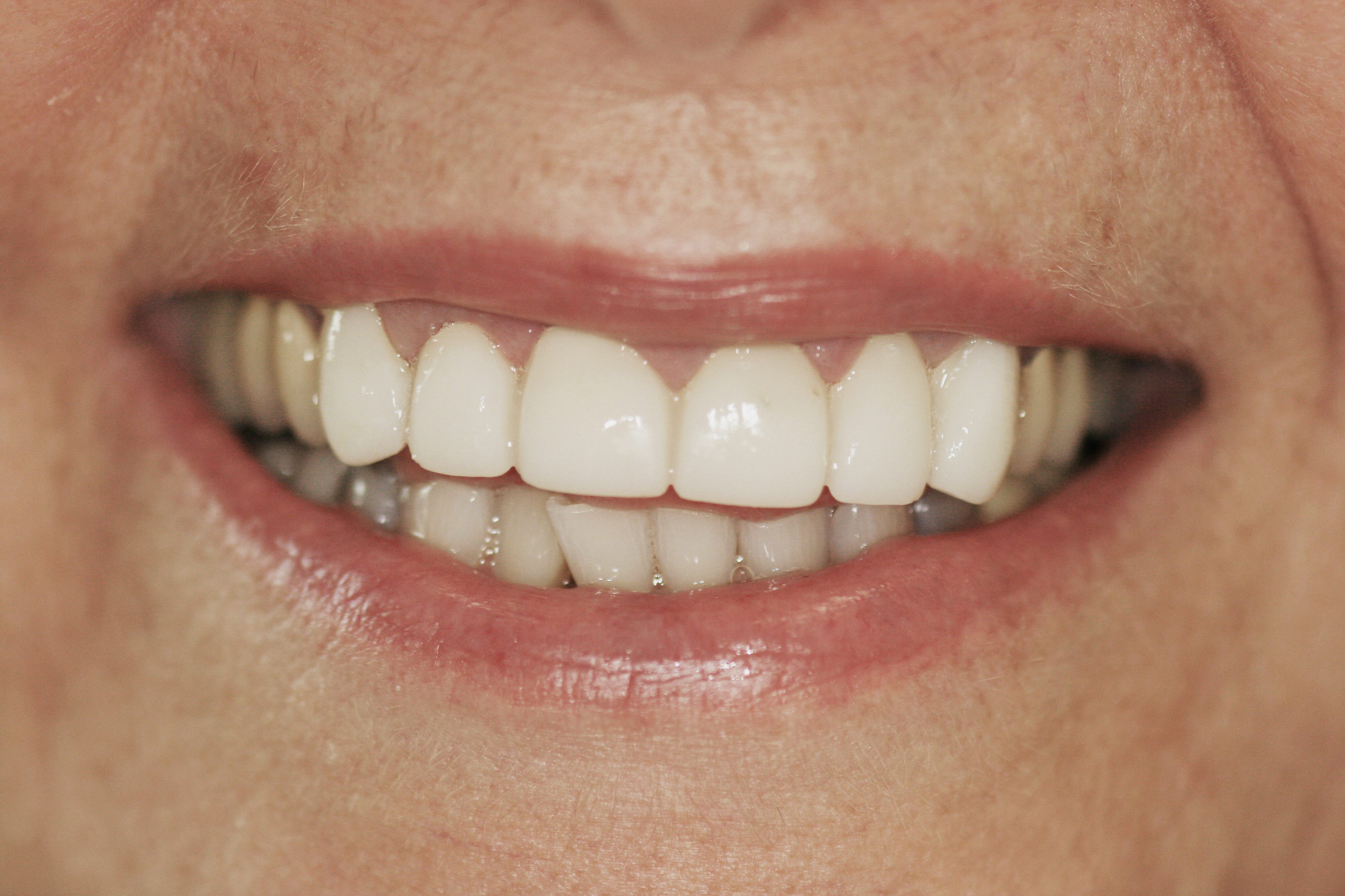 Smile Gallery