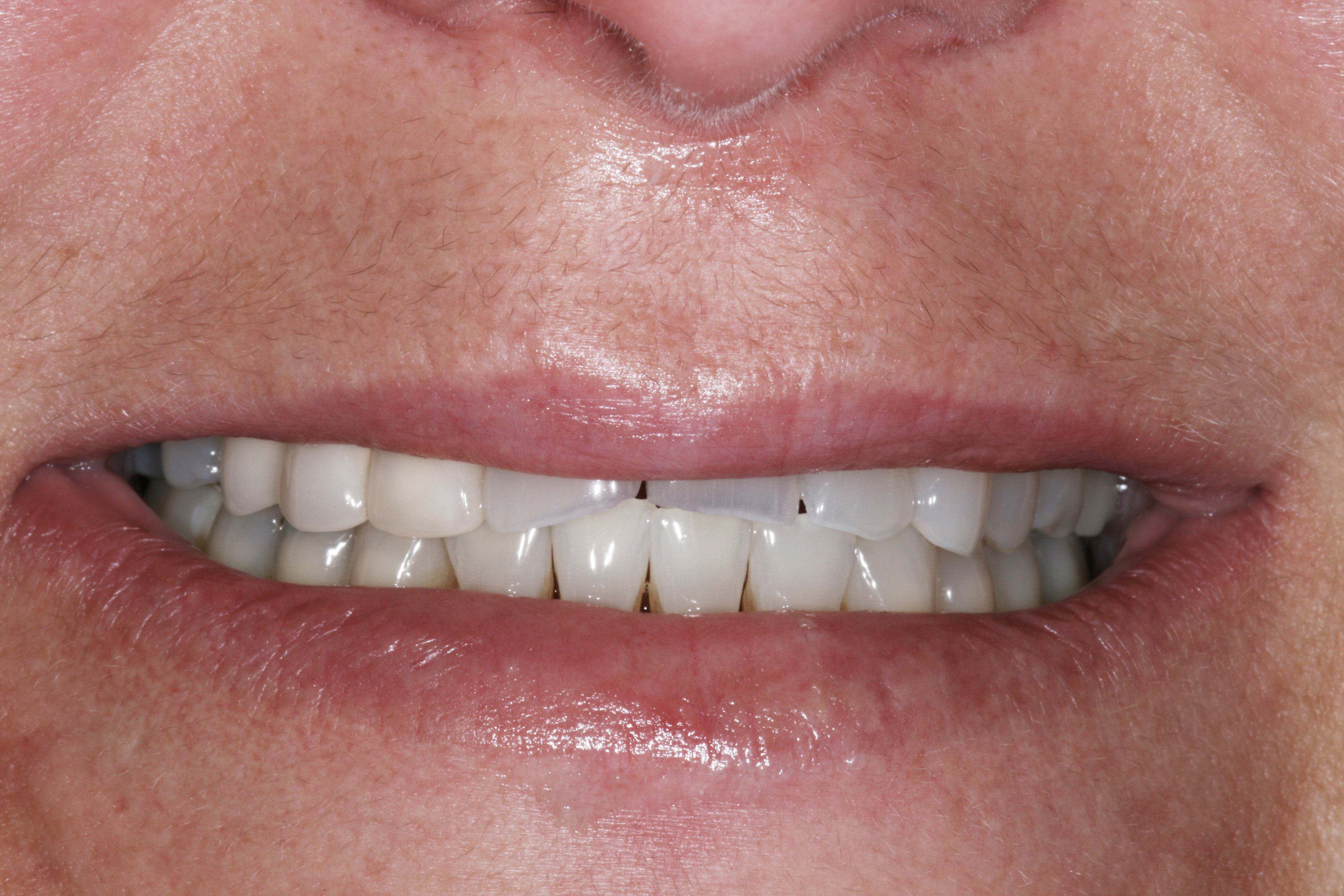 Smile Gallery