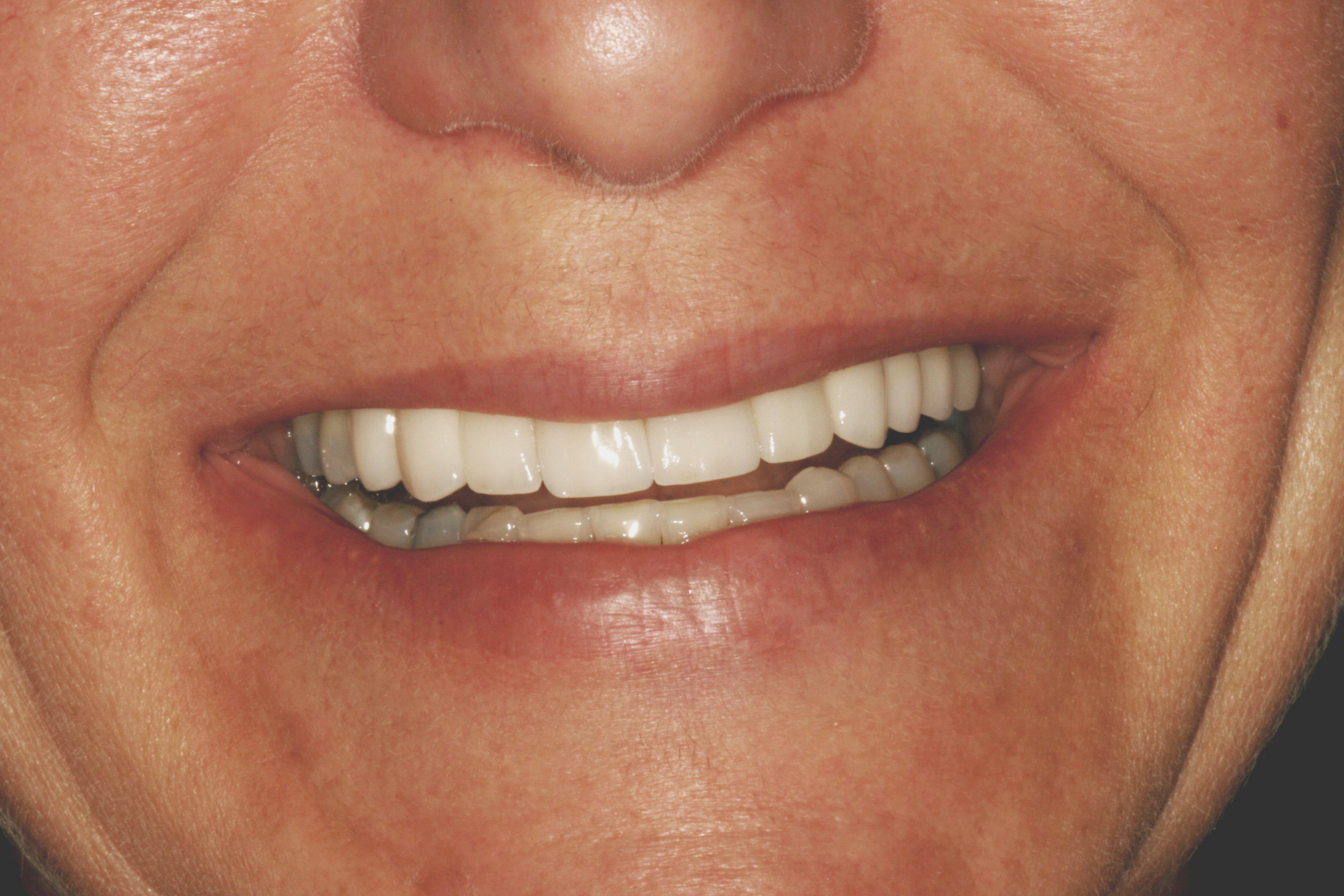 Smile Gallery