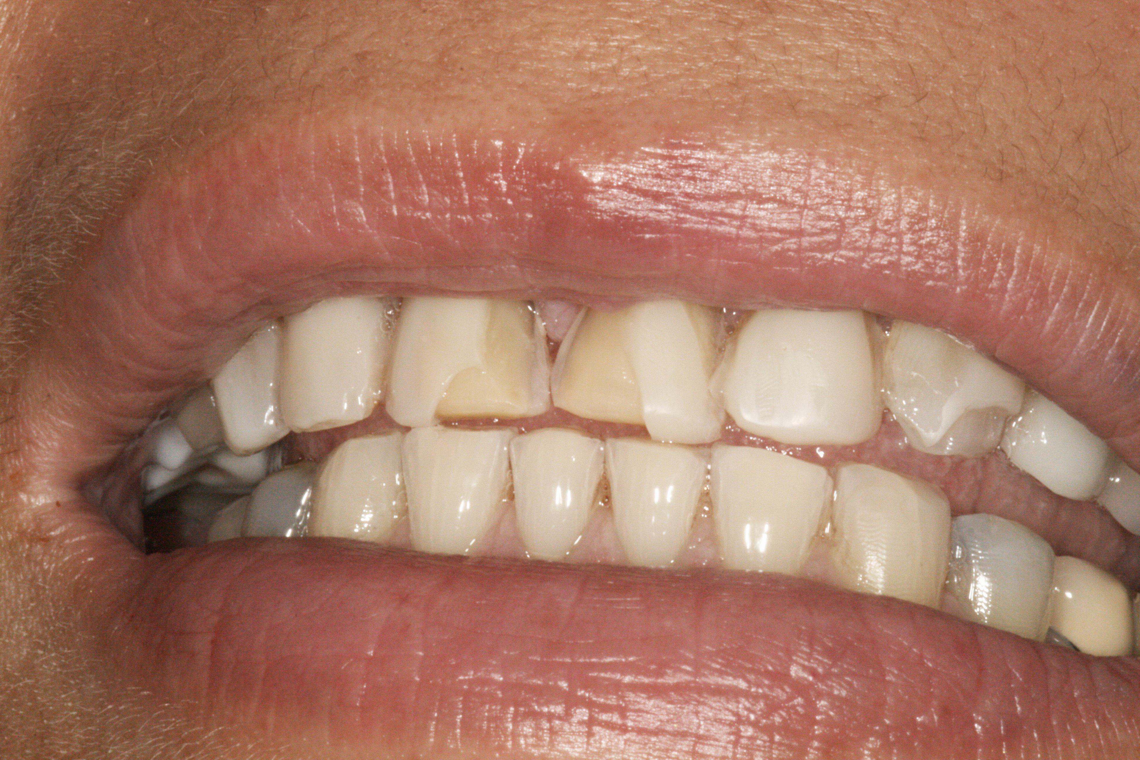 Smile Gallery