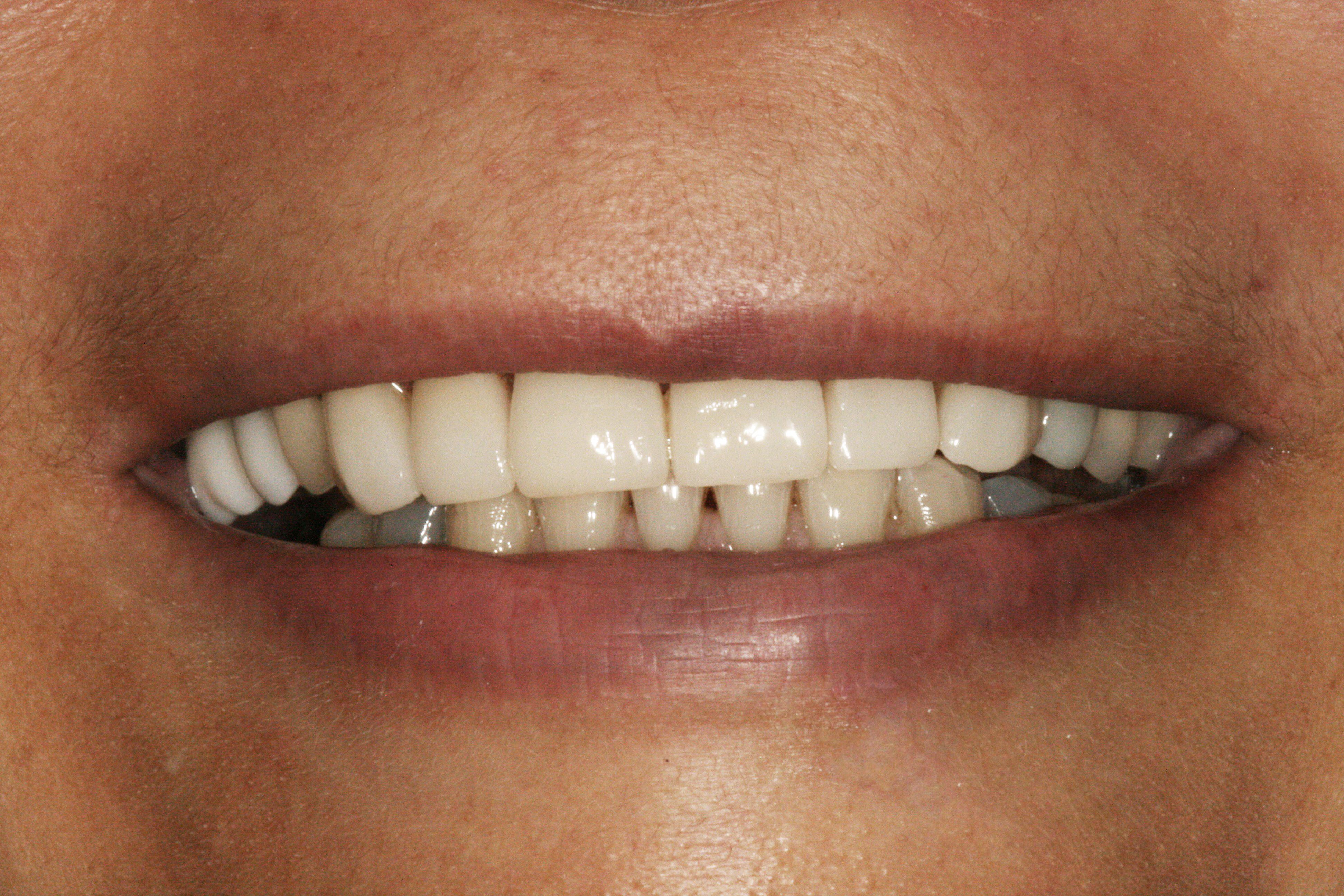 Smile Gallery